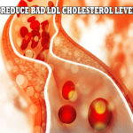 CHOLESTEROL